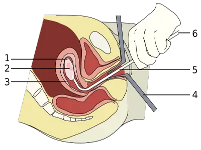 Safe and Legal Abortion in Bhopal | Dr. Sonil Srivastava
