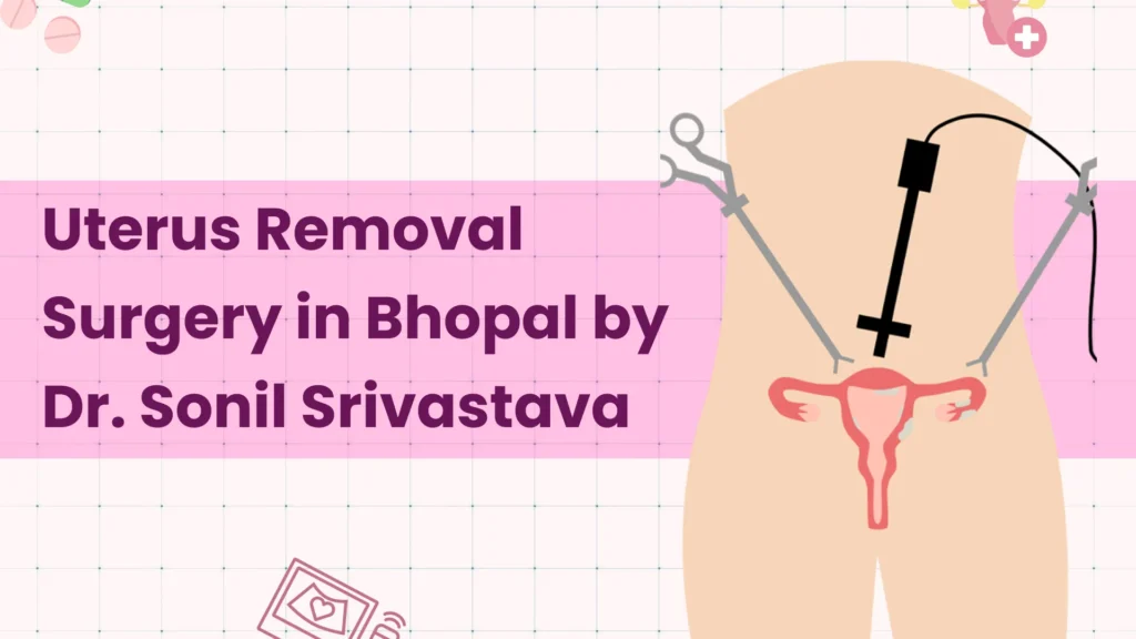 Uterus Removal Surgery in Bhopal by Dr. Sonil Srivastava