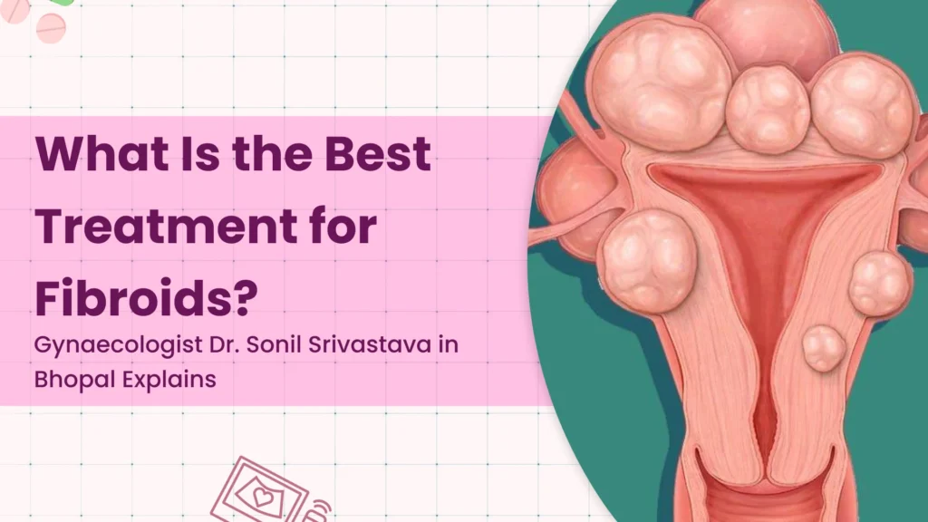 What Is the Best Treatment for Fibroids? Gynaecologist Dr. Sonil Srivastava in Bhopal Explains