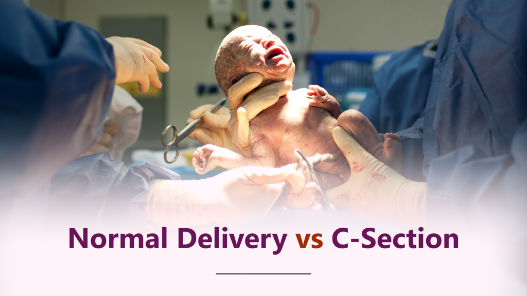 Normal Delivery vs C-Section: What Every Pregnant Woman in Bhopal Should Know