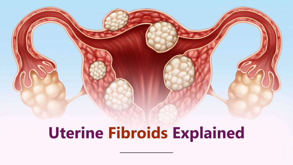 Uterine Fibroids in Bhopal: Symptoms, Diagnosis & When You Need Surgery