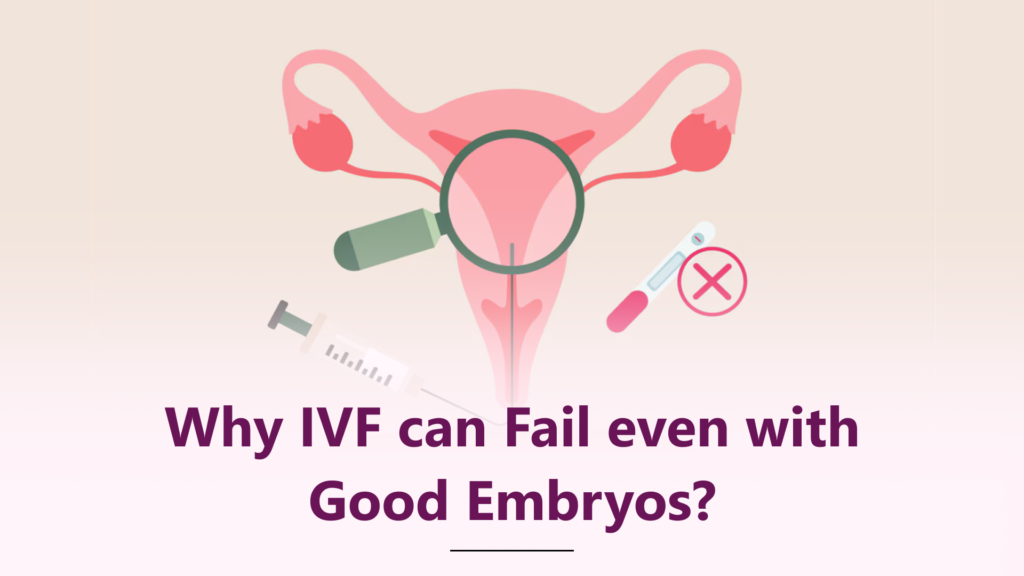 Why Does IVF Fail Even with Good Embryos? Common Reasons for Implantation Failure