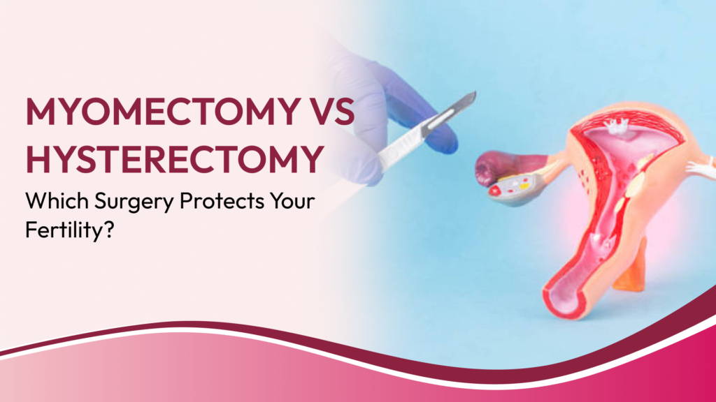 Myomectomy vs Hysterectomy for Large Fibroids: Which Surgery Is Considered When Fertility Preservation Matters?