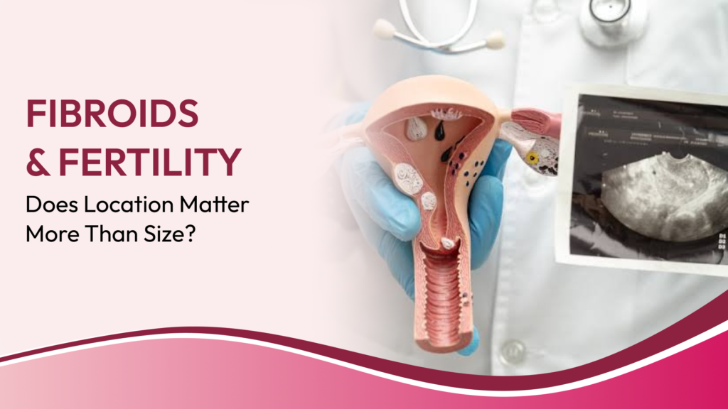 Fibroid Location and Fertility: Why Submucosal, Intramural and Subserosal Fibroids Are Treated Differently